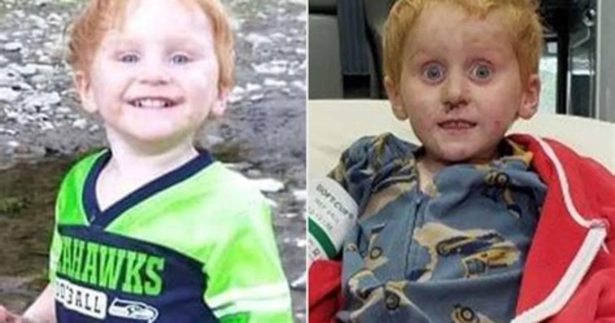 Before and After of Ryker Webb