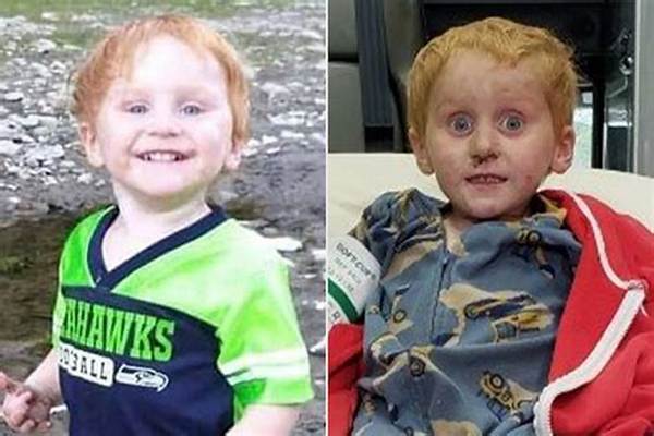 Before and After of Ryker Webb
