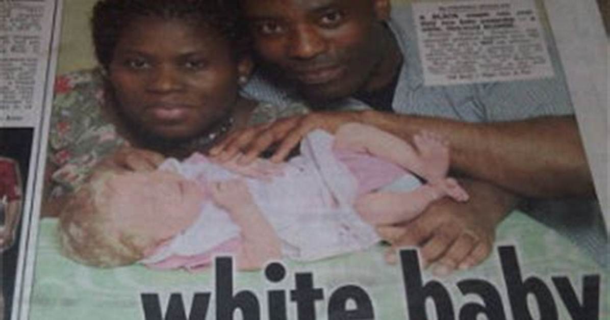 Black Nigerian Couple Give to Birth a White Child (Photos)