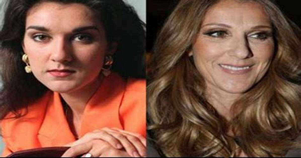 Celine Dion Open to Cosmetic Surgery, Worried About Botox
