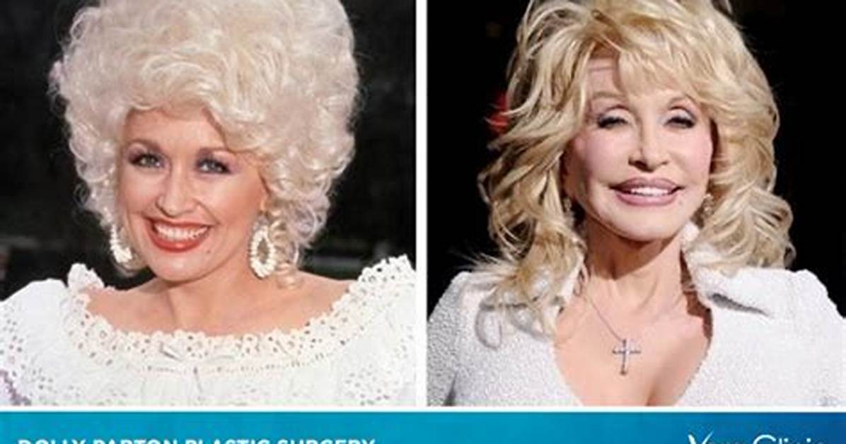 Has Dolly Parton Had Plastic Surgery? What Plastic Surgery Has Dolly Parton Had?