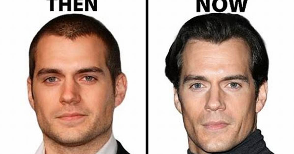 Has Henry Cavill Had Plastic Surgery? Who Is Henry Cavill?