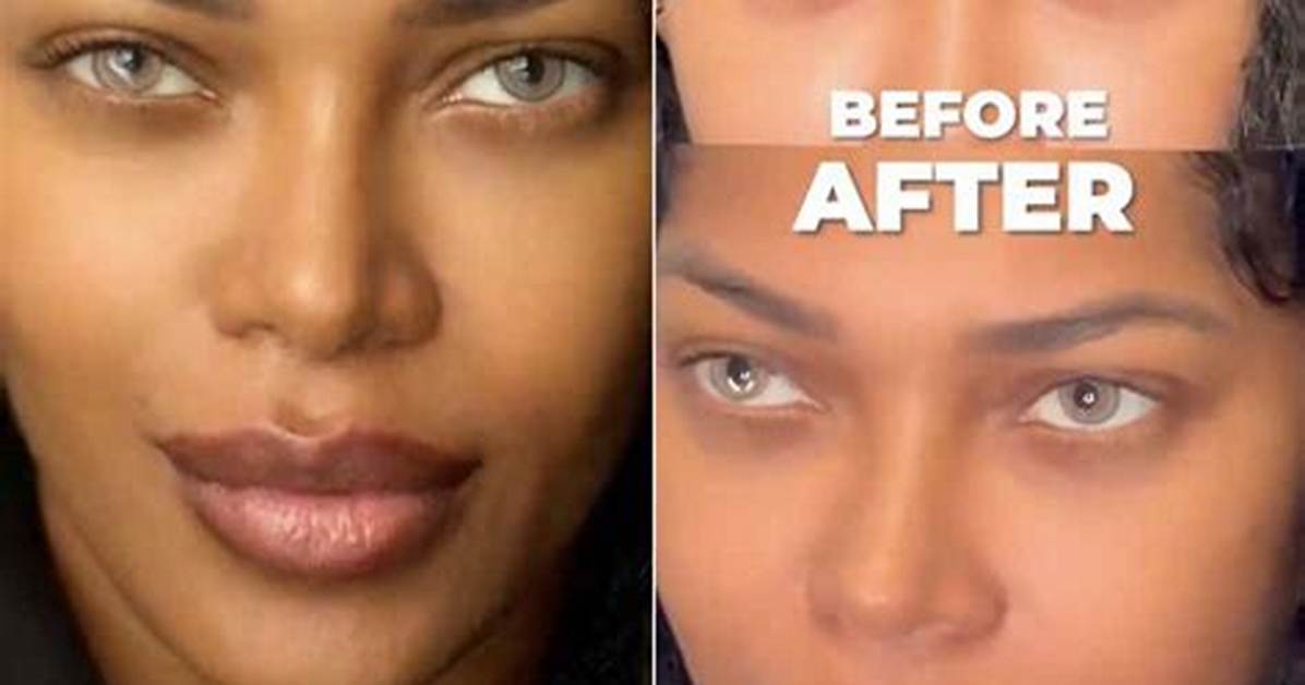 Jessica White Plastic Surgery Before and After