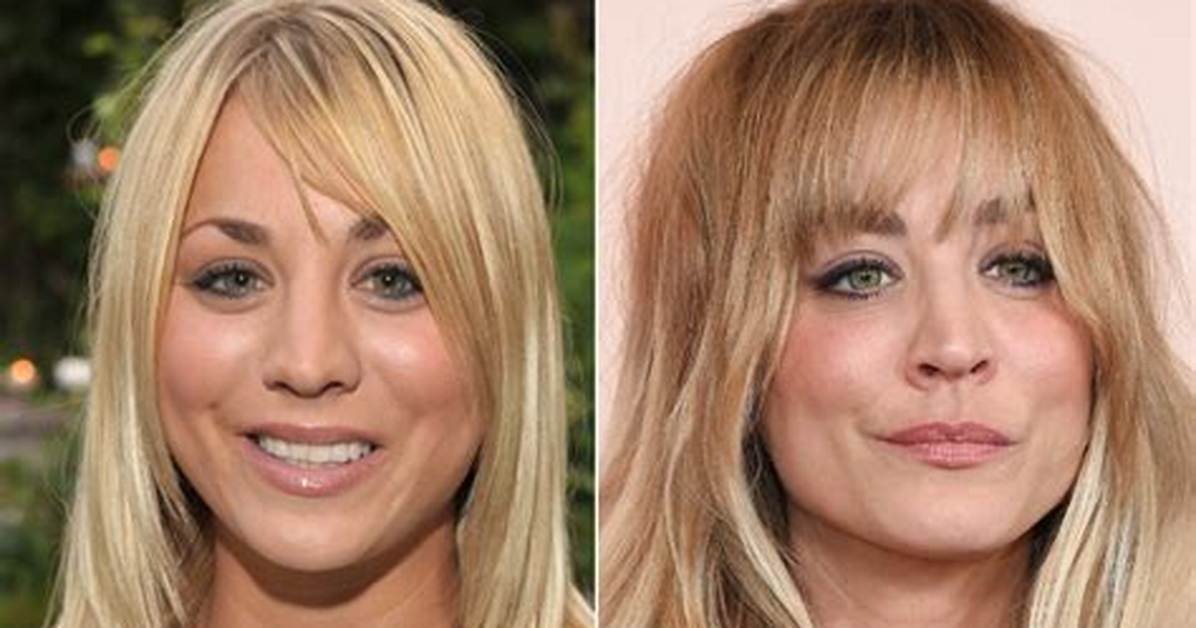 Kaley Cuoco Admits Nose and Breast Job: Big Bang Theory Star Says Plastic Surgery Was the Best Thing She Ever Did