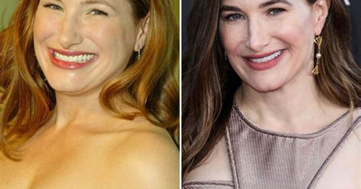 Kathryn Hahn Plastic Surgery Before and After
