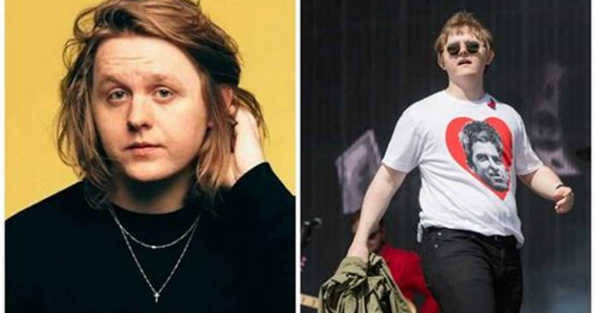 Lewis Capaldi Bio, Age, Parents, Wife, Children, Net Worth