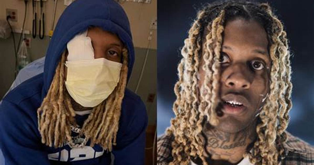 Lil Durk Was Injured When Smoke Hit His Face During Lollapalooza Festival