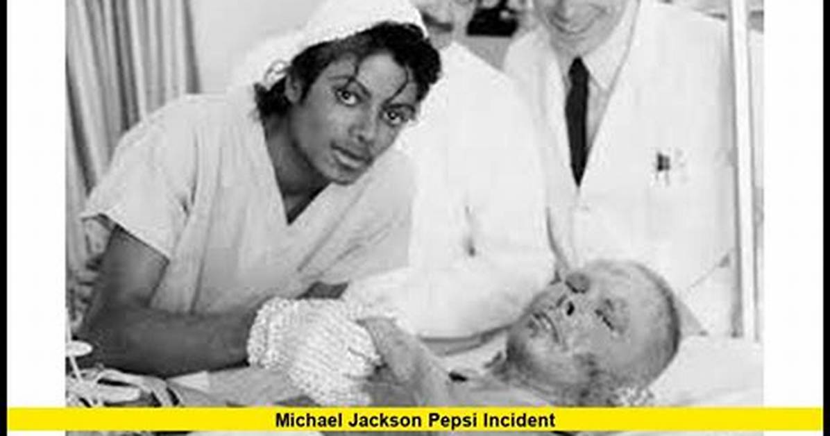 Michael Jackson Burned in Pepsi Spot
