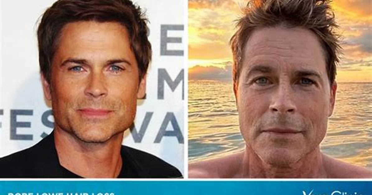 Rob Lowe Weight Loss Before and After: How Did Rob Lowe Lose His Weight?