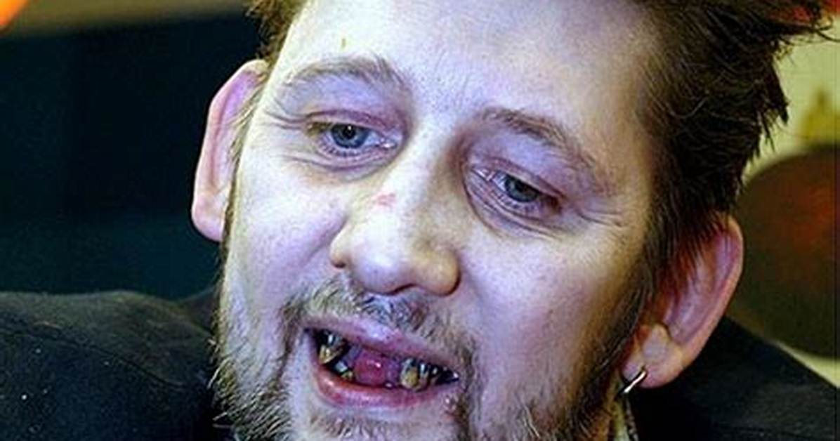 Shane Macgowan Net Worth 2024, Age, Height, Bio, Birthday, Wiki!