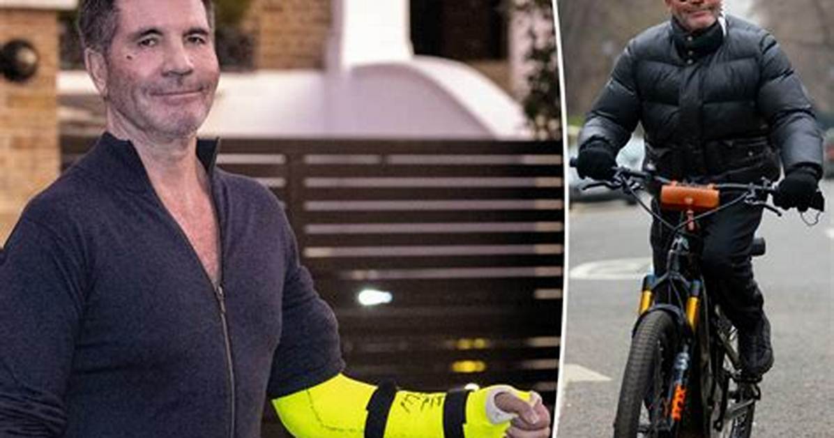 Simon Cowell Had Another E-Bike Accident That Broke His Arm