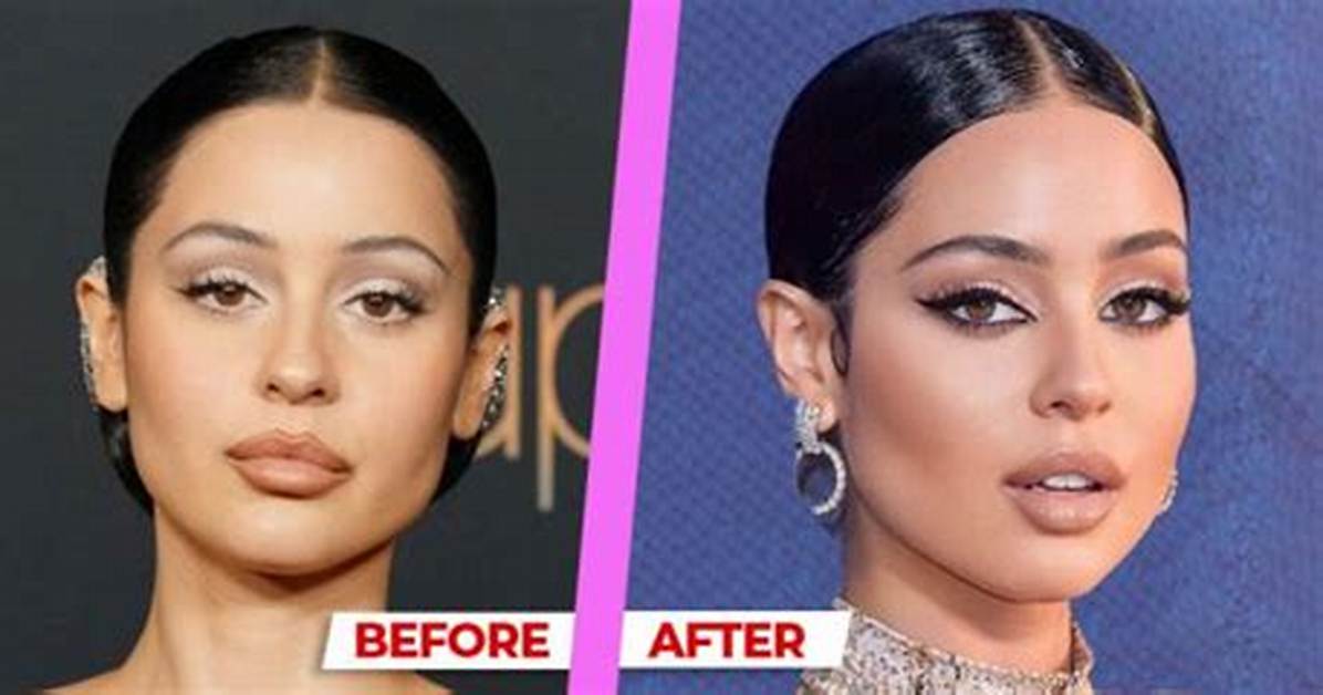 What Surgery Did Alexa Demie Have?