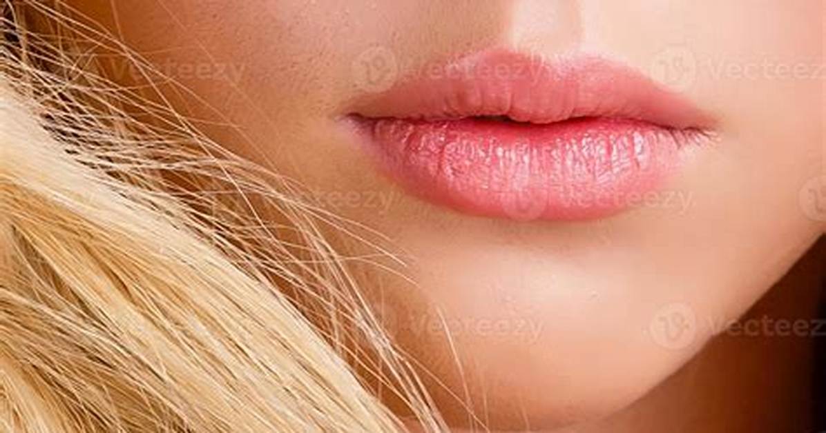 Woman’s Lips over-Enlarges to ‘Eight Times the Normal Size’ After Injecting Lip Fillers